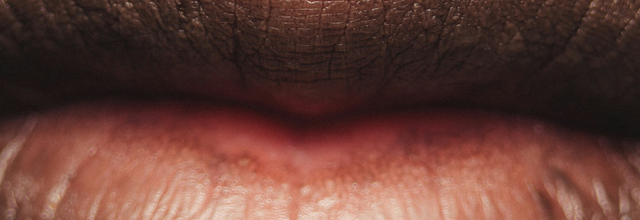 Ново проучване потвърждава удвоения риск от деменция след вируса на херпес симплекс в устата